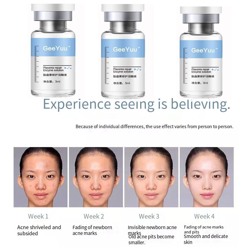 Placent Peptide Ampoule Hyalur - Placenta Extract Serum avis et prix
